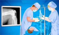 Operate Now: Bedah Lutut